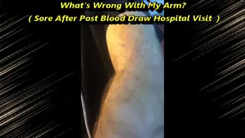 What’s Wrong With My Arm? Visit His Channel Please