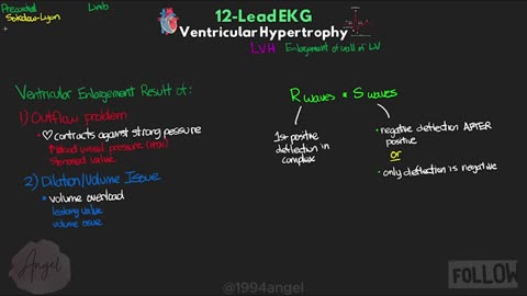 Ventricular Hypertrophy (LVH & RVH) on 12-Lead EKG