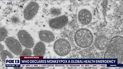 W.H.O. declares monkeypox a global health emergency | FOX 13 Seattle