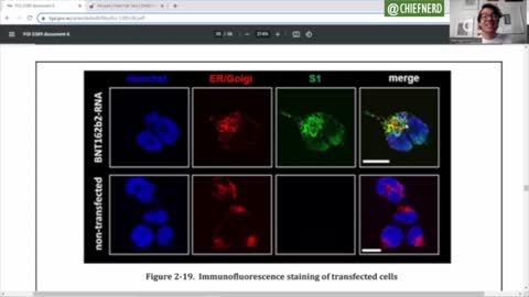 HUGE! Dr. Raszek reviews Pfizer document showing spike protein from the vaccines enters the nucleus