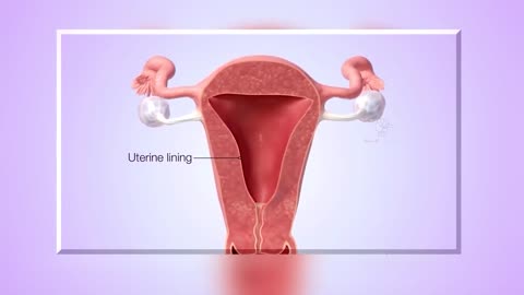 How Intrauterine devices (IUDs) Works To Control Birth?