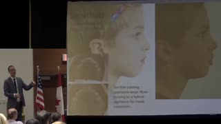 Effect of Extra-Oral Anchorage on Craniofacial Development By Dr Mike Mew. Vancouver | November 2016