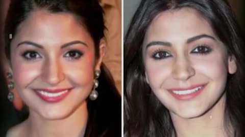 Actress with plastic surgery