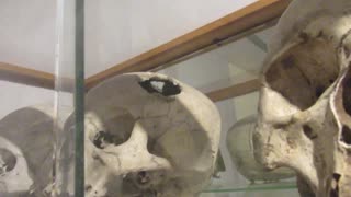 Trepanation & Elongated Skulls