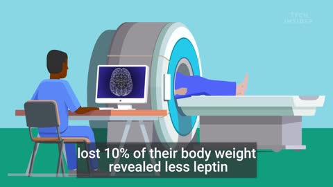 What Lesing Weight Does To Your Body And Brain | The Human Body