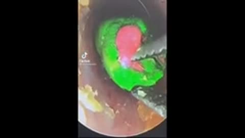 satisfying earwax removing