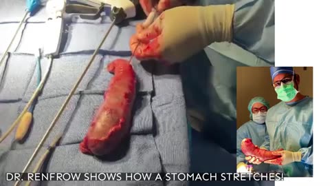 Shocking Stomach Stretch: Dr. Renfrow Unveils the Science Behind it