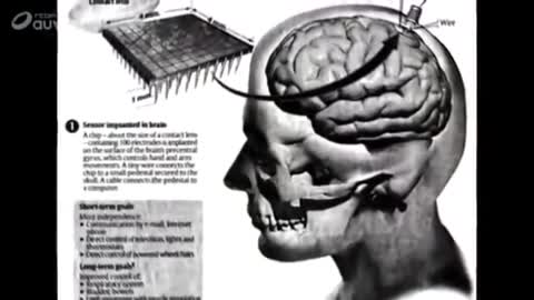 MK ULTRA - contrôle du cerveau à distance par implantation d'électrodes