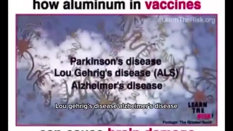 Leading expert explain how aluminum in vaccine can cause brain damage.