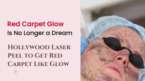 Dreaming Of Red Carpet Like Glow? Try Hollywood Laser Peel And Glow Like A Hollywood Star