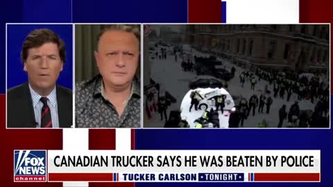 Canadian trucker explains to Tucker Carlson about being attacked by Trudeau's minions