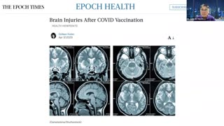 Brain Injuries After COVID Vaccination