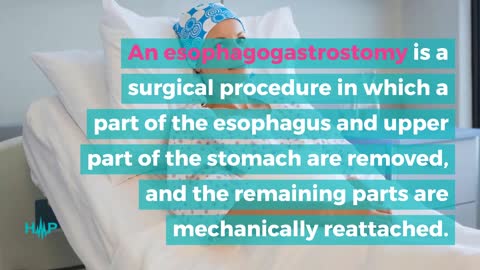 How To Treat Esophageal Cancer
