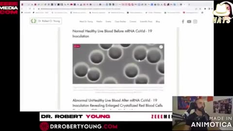 "IT'S LIKE A WAR ZONE IN THE BLOOD" GRAPHINE OXIDE CONTAMINATION