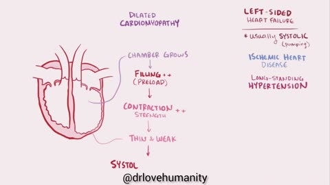 Congestive heart failure 03-09-2023