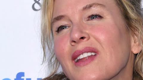 What Happened to Renee Zellweger?