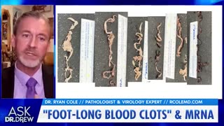 Dr. Ryan Cole, tells Dr. Drew about foot-long clots he's been finding in mRNA injected patients