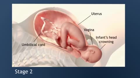 Stages Of Labor Early Labor, Active Labor and Transition Stage