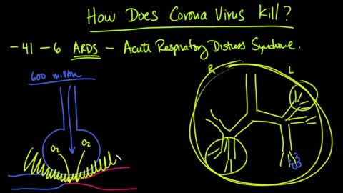 COVID-19 kills ARDS vs. Vaccine Treatments