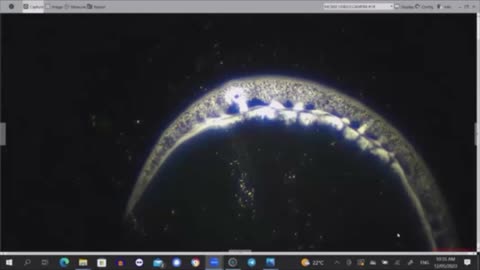 WARNING nano graphene hydrogels on dental anaesthetics