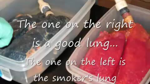What Smoking Brings For Your Lungs