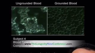 What happens to your blood after you have grounded - WOW!