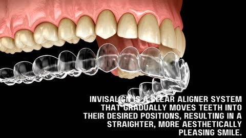 Invisalign for Busy Professionals: Enhancing Smiles Effortlessly