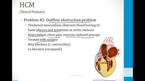 Cardiology - 9. Other Cardiovascular Topics - 6.Hypertrophic Cardiomyopathy