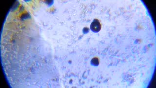 Spirulina Chlorella and unknown sphere