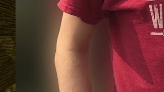 10 million subs elbow reveal