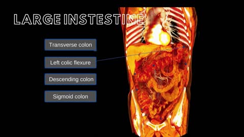 Large Intestine and Umbilical Hernias