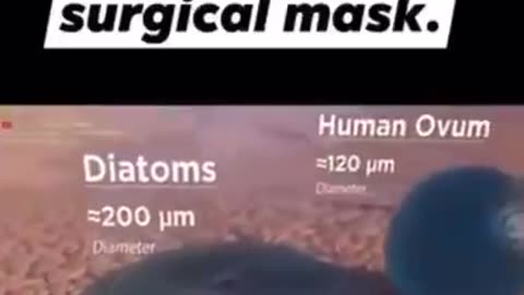 A GREAT EXAMPLE OF WHY MASKING IS WORTHLESS - THINGS THAT WILL GET THROUGH A SURGICAL MASK
