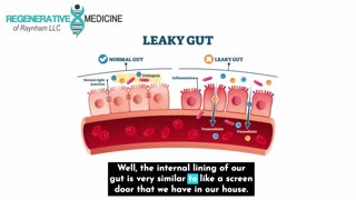 Help With Leaky Gut. A Common Overlooked Disorder