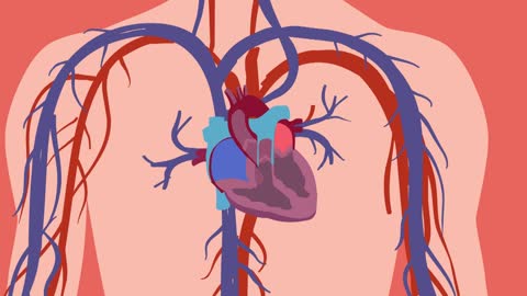 How an Embolus is released from heart to the brain