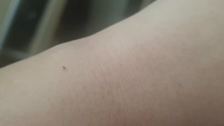 Tiniest baby spider on my arm