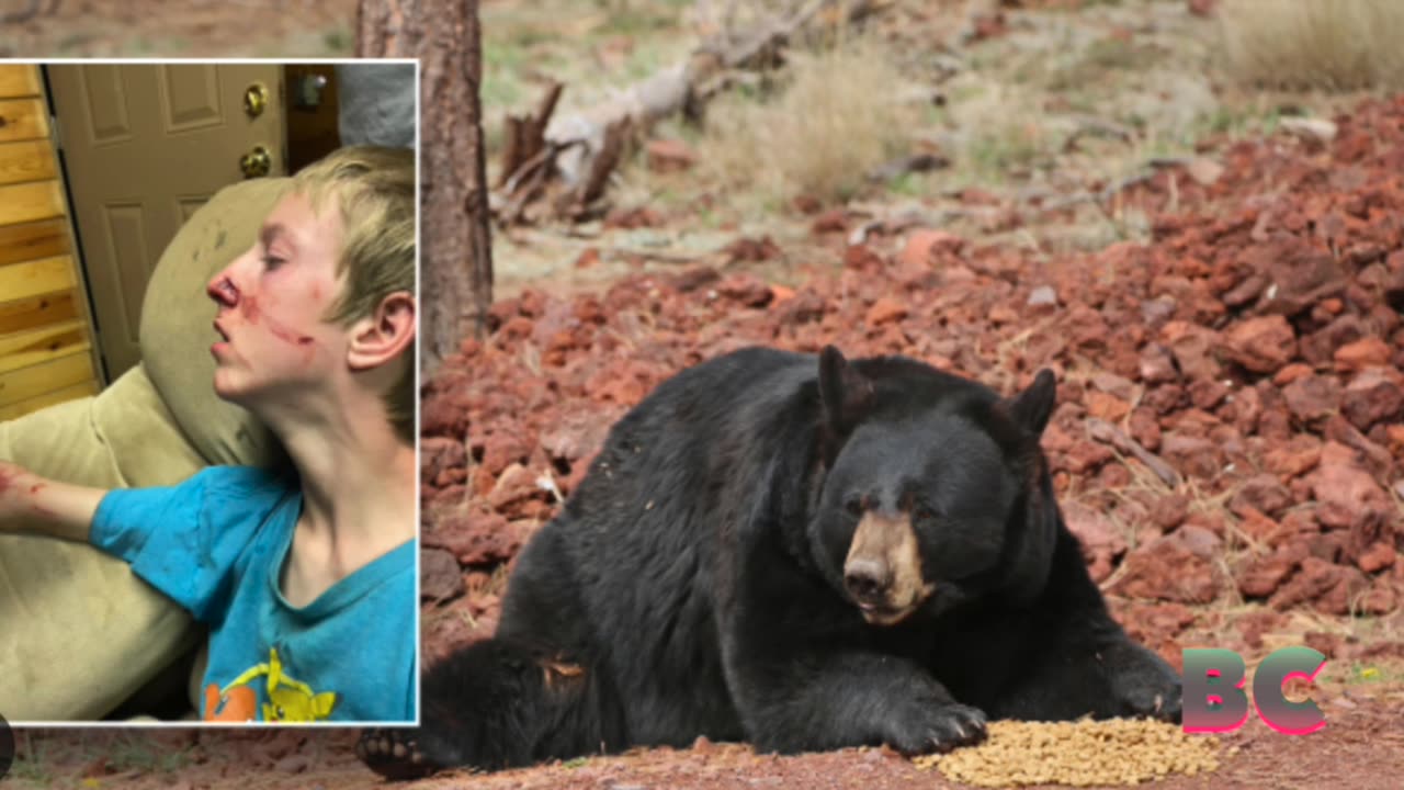 Bear mauls teen with rare disorder as he watched TV in Arizona cabin(02)