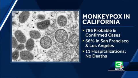California health official says monkeypox state of emergency is still being considered