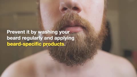 How to Grow a Beard - Tips and Tricks