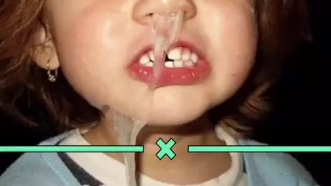 How to stop a runny nose, Disgusting Runny nose kid,