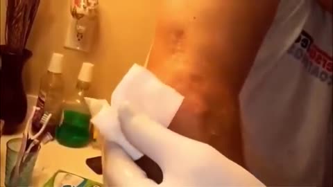 "🌀 ENIGMA UNLEASHED: TOP 50 Disturbing Pimple Popping Videos 2022 😱"