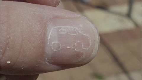 Fingernail Goes for a Drive