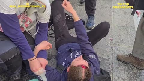 PARIS, Protester seriously injured with a cracked skull