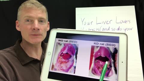Your Liver LOVES Ketosis! And so do your other organs! Visual proof.160