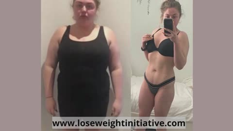 Before & After Weight-Loss