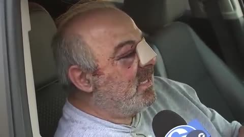 Uber Driver Recounts Being Viciously Attacked
