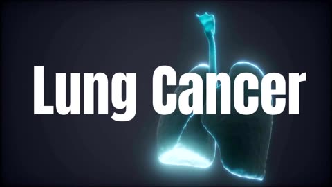 BioCare Health Network Managing Lung Cancer (2023-04-14)