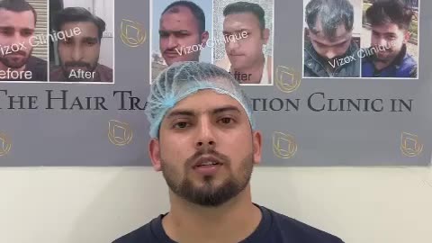 Hair Transplant Clinic in Chandigarh | Hair Transplant Results | Vizox Clinique #hairtransplant
