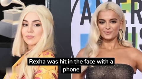 Singer Ava Max slapped on stage, days after Bebe Rexha was hit with a phone while performing