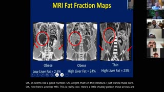 134. Fructose: Why it is SO harmful - Dr. David Harshfield