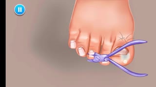 Nails caring tip watch and care your Niels